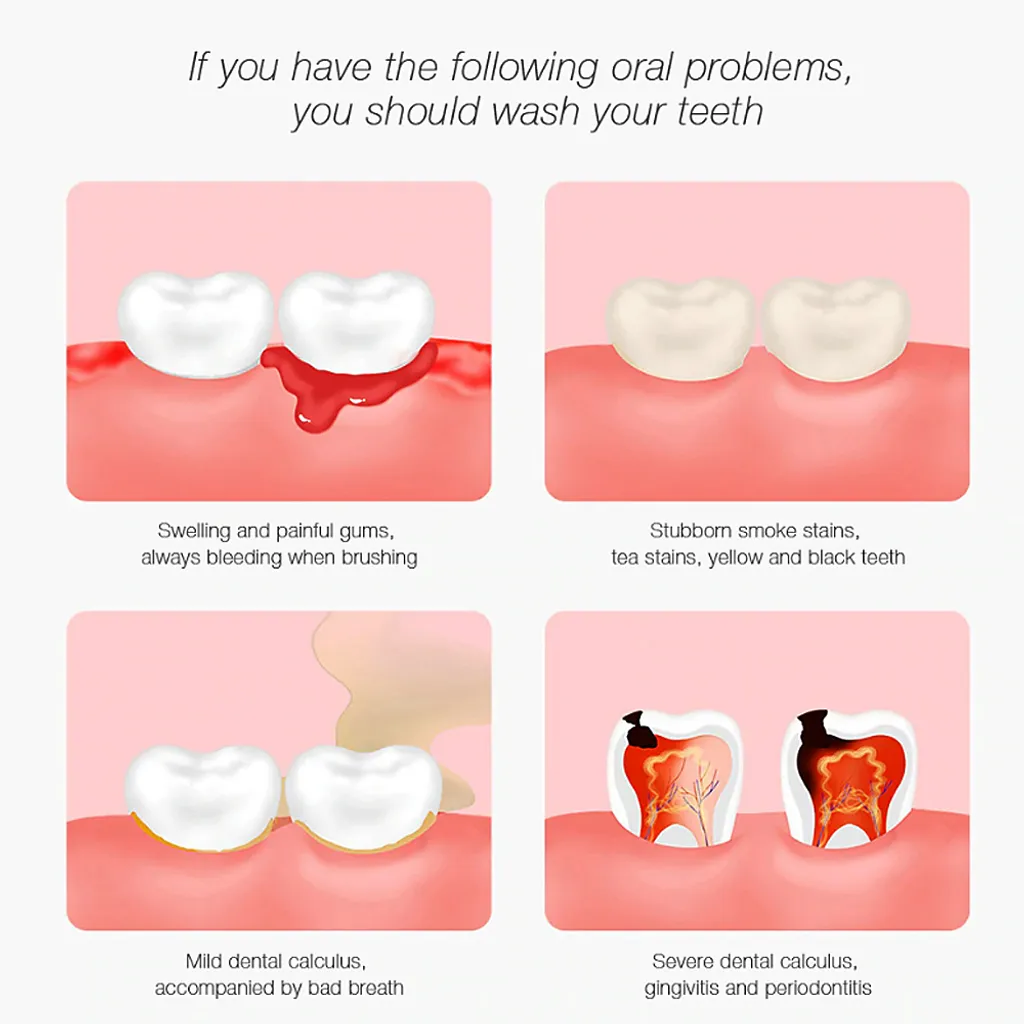 DR.BEI YC2 Ultraschall-Scaler IPX7 Wasserdichter Zahnsteinentferner mit 3 Modi / LED-Zusatzscheinwerfer Tragbarer wiederaufladbarer Zahnstein-Zahnsteinschaber Elektrischer Plaque-Entferner Zahnflecken-Reinigungswerkzeug fuer Erwachsene DR.BEI YC2 Ultraschall-Scaler IPX7 Wasserdichter Zahnsteinentferner Mit 3 Modi / LED-Zusatzscheinwerfer Tragbarer Wiederaufladbarer Zahnstein-Zahnsteinschaber Elektrischer Plaque-Entferner Zahnflecken-Reinigungswerkzeug Fuer Erwachsene -Kaufland Geschäft 7d68da43f50c1051c2b62c635b5e33c2