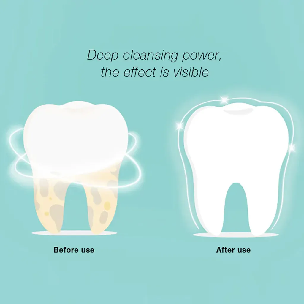 DR.BEI YC2 Ultraschall-Scaler IPX7 Wasserdichter Zahnsteinentferner mit 3 Modi / LED-Zusatzscheinwerfer Tragbarer wiederaufladbarer Zahnstein-Zahnsteinschaber Elektrischer Plaque-Entferner Zahnflecken-Reinigungswerkzeug fuer Erwachsene DR.BEI YC2 Ultraschall-Scaler IPX7 Wasserdichter Zahnsteinentferner Mit 3 Modi / LED-Zusatzscheinwerfer Tragbarer Wiederaufladbarer Zahnstein-Zahnsteinschaber Elektrischer Plaque-Entferner Zahnflecken-Reinigungswerkzeug Fuer Erwachsene -Kaufland Geschäft cf85986b892b2875c1359d4450d0bc9d